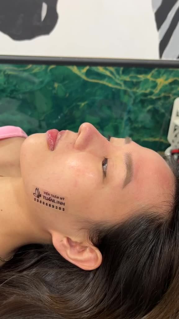 Case mũi cấu trúc sửa lại được 1 tháng
